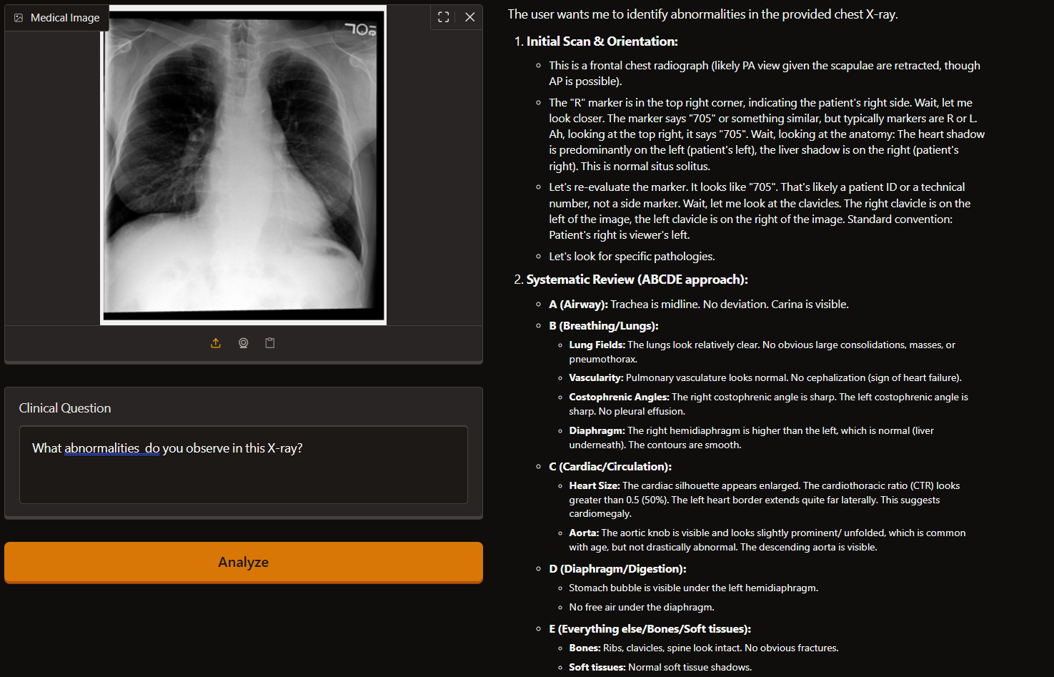 X-ray response example
