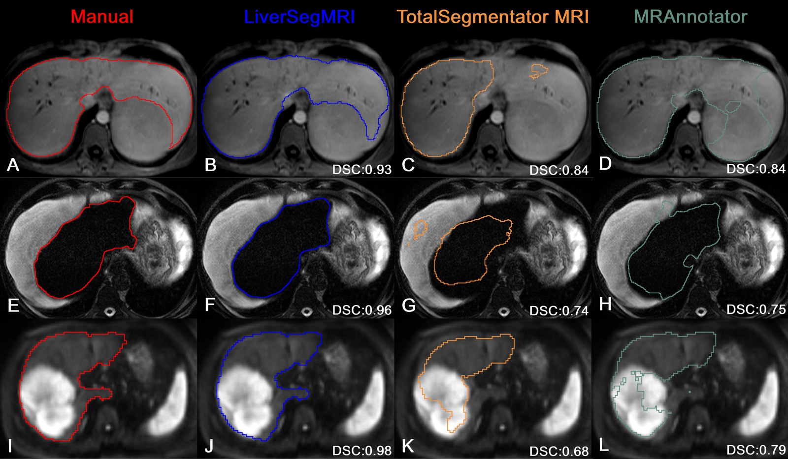 Liver contours from the manual reference and the three models on three MRI sequences, with Dice values