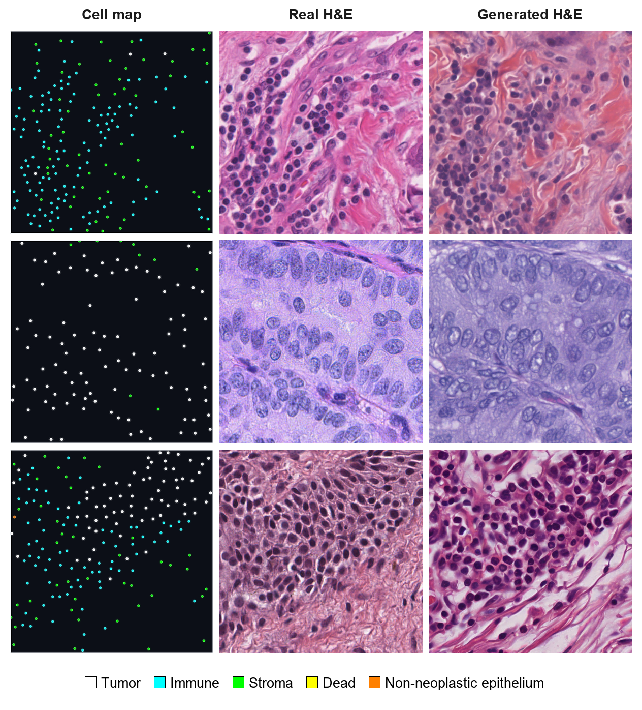 Three examples showing the cell map, real H&E tile, and generated H&E tile