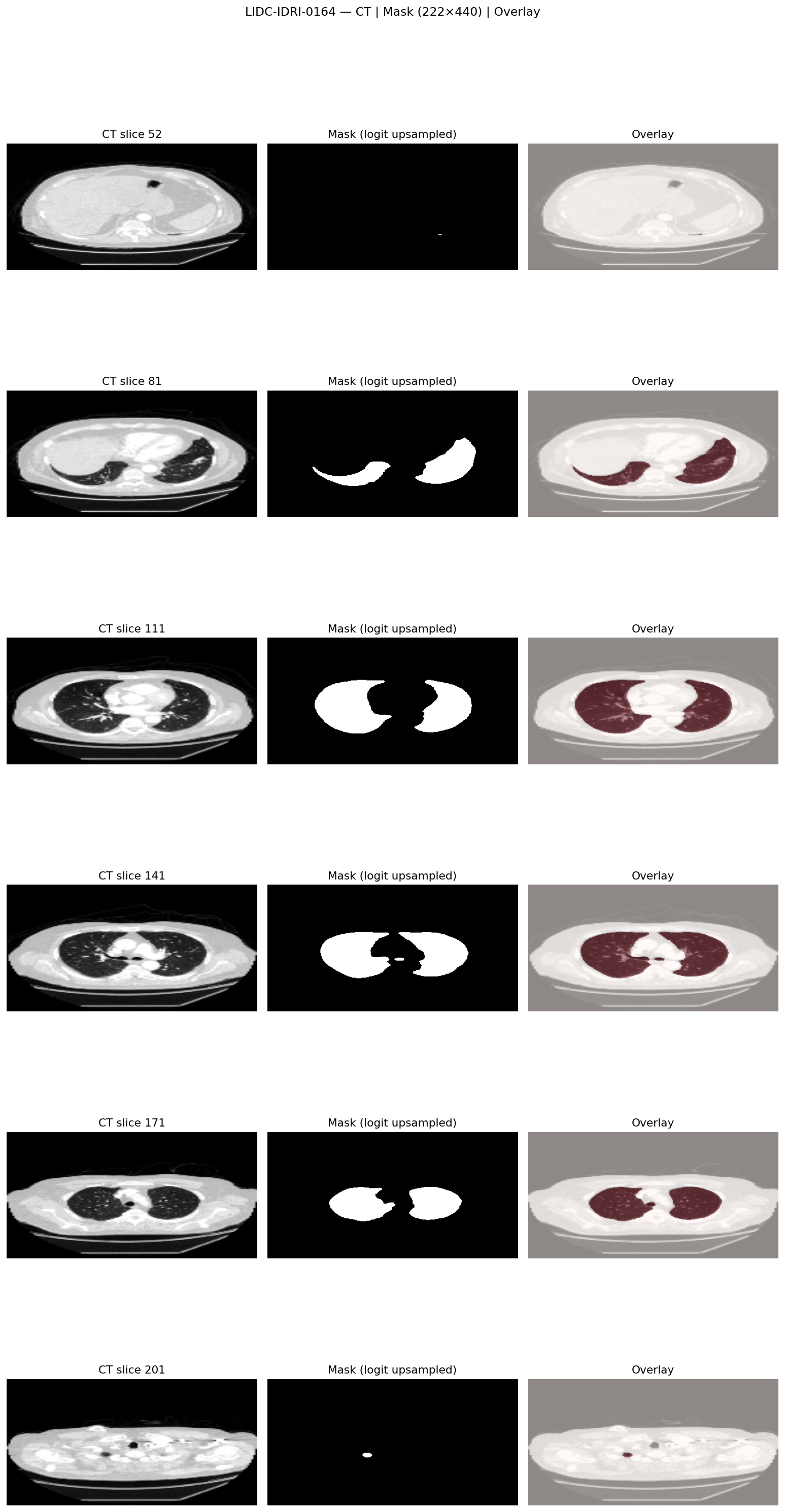 LIDC-IDRI-0164_preview.png