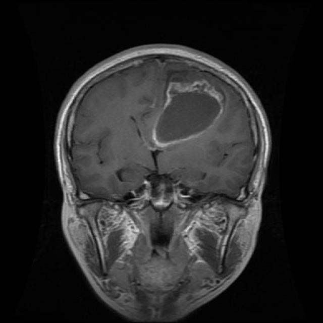 Te-gl_0042_jpg.rf.7e07b75646f9e42756eae8a7859514a1.jpg