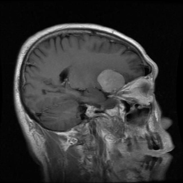 Te-me_0219_jpg.rf.2ae2ab242485f9297c53069ba6436ec1.jpg