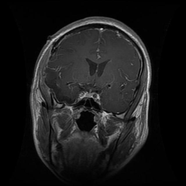 Te-gl_0134_jpg.rf.dbdf642a44340754a523d8e4a155eca1.jpg