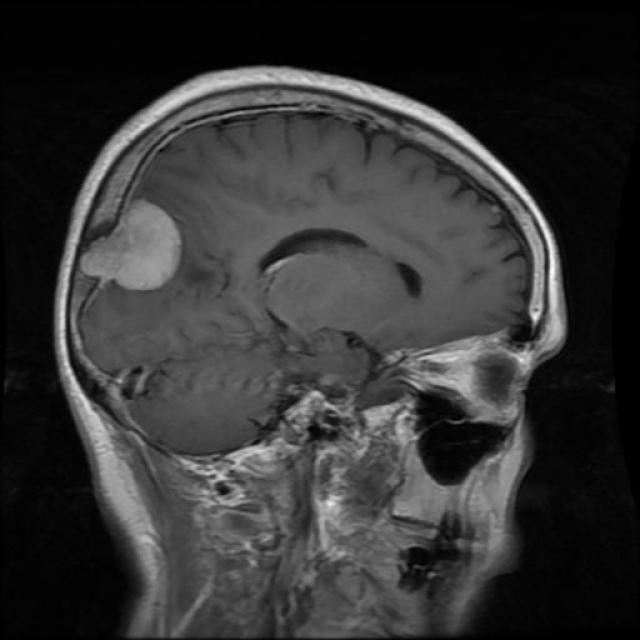 Te-me_0240_jpg.rf.8563cea53672ecc1594e63f776130d4f.jpg