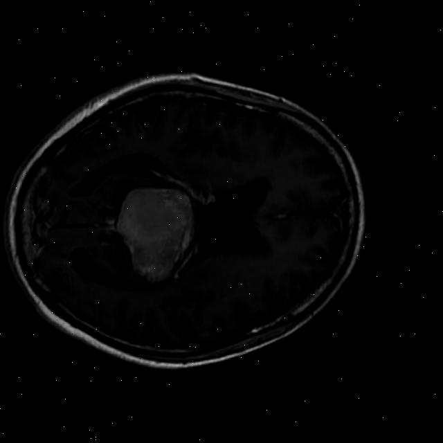 Tr-me_0820_jpg.rf.d7d52288079ce734f8d90c9fb45fd73d.jpg