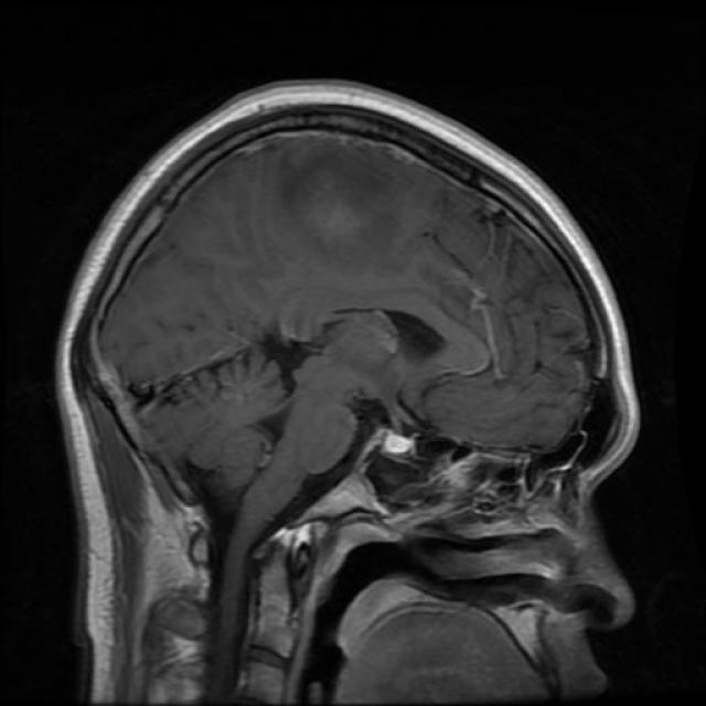 Te-gl_0267_jpg.rf.379497cd64ae084506e68639ae7e5742.jpg