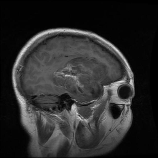 Te-gl_0269_jpg.rf.b1852e9ae7108344f83b768c516e58c4.jpg