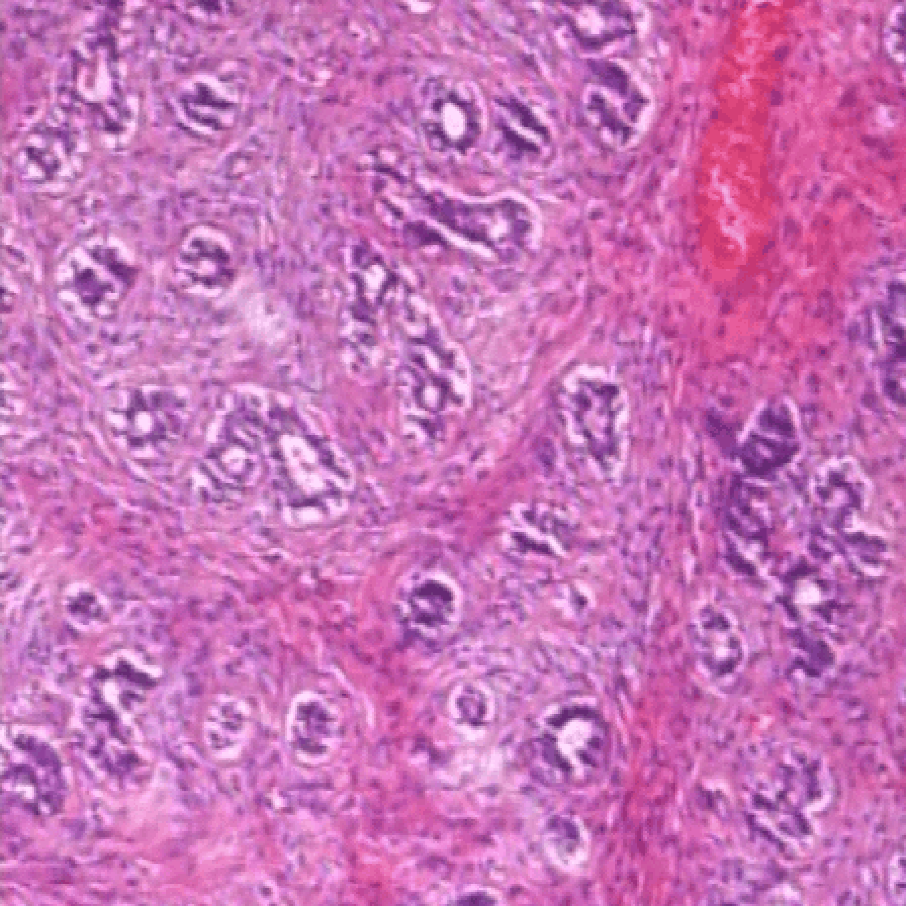 Graph-BreakHis teaser – cell-graph construction from a histopathology image