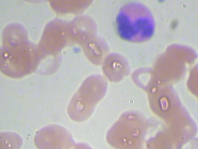 BCCD_example_6.jpg