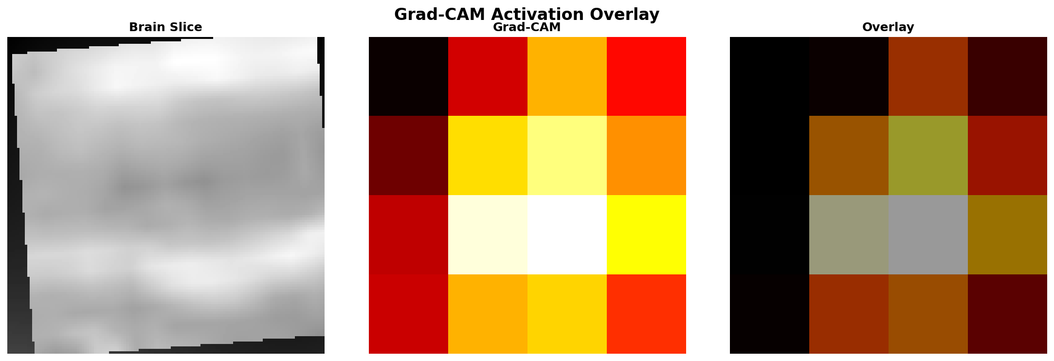 Grad-CAM Overlay 3