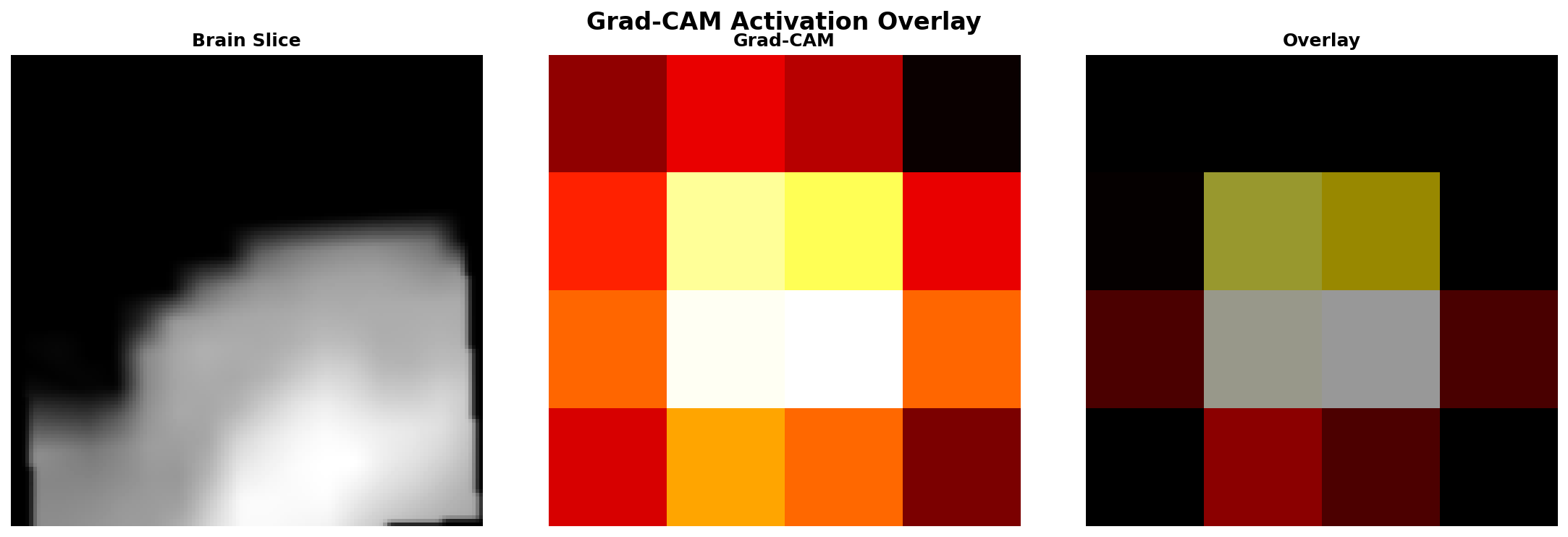 Grad-CAM Overlay 7