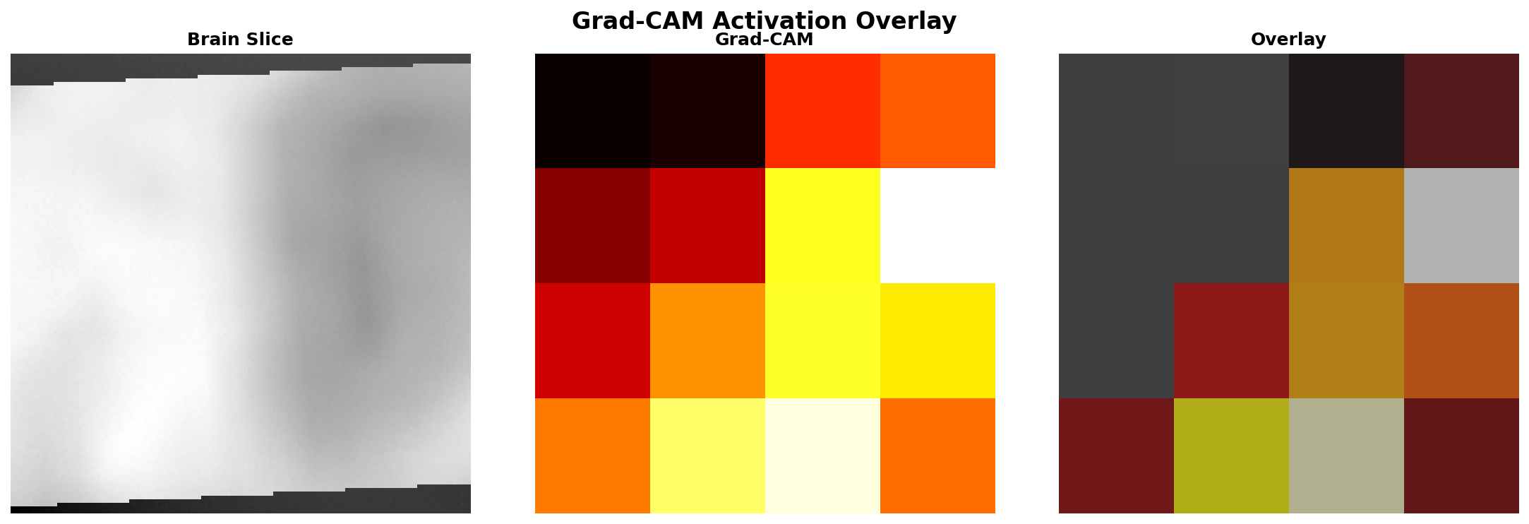 Grad-CAM Overlay 8