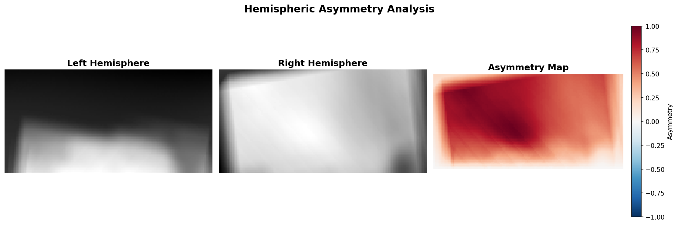 Asymmetry 0