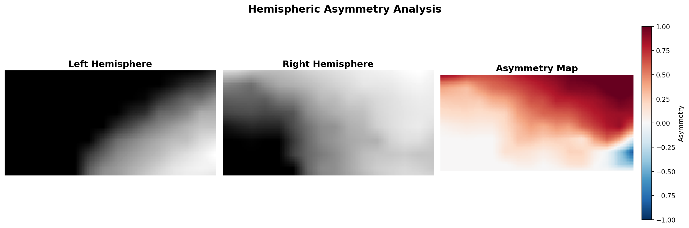 Asymmetry 1