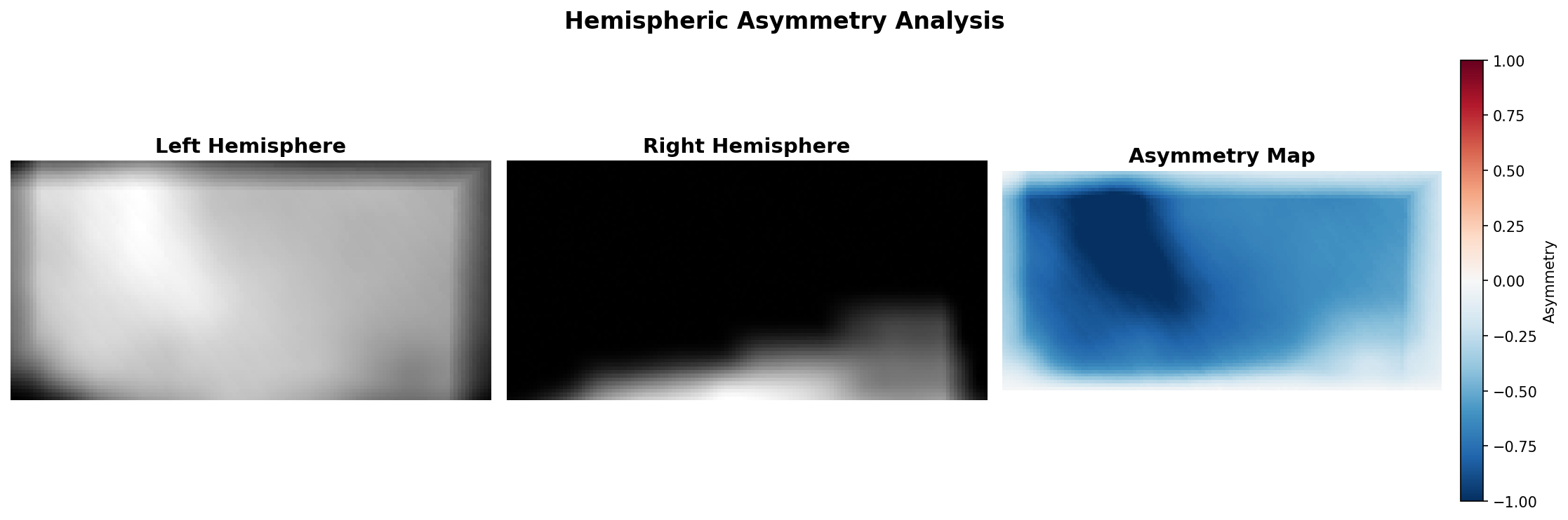 Asymmetry 2