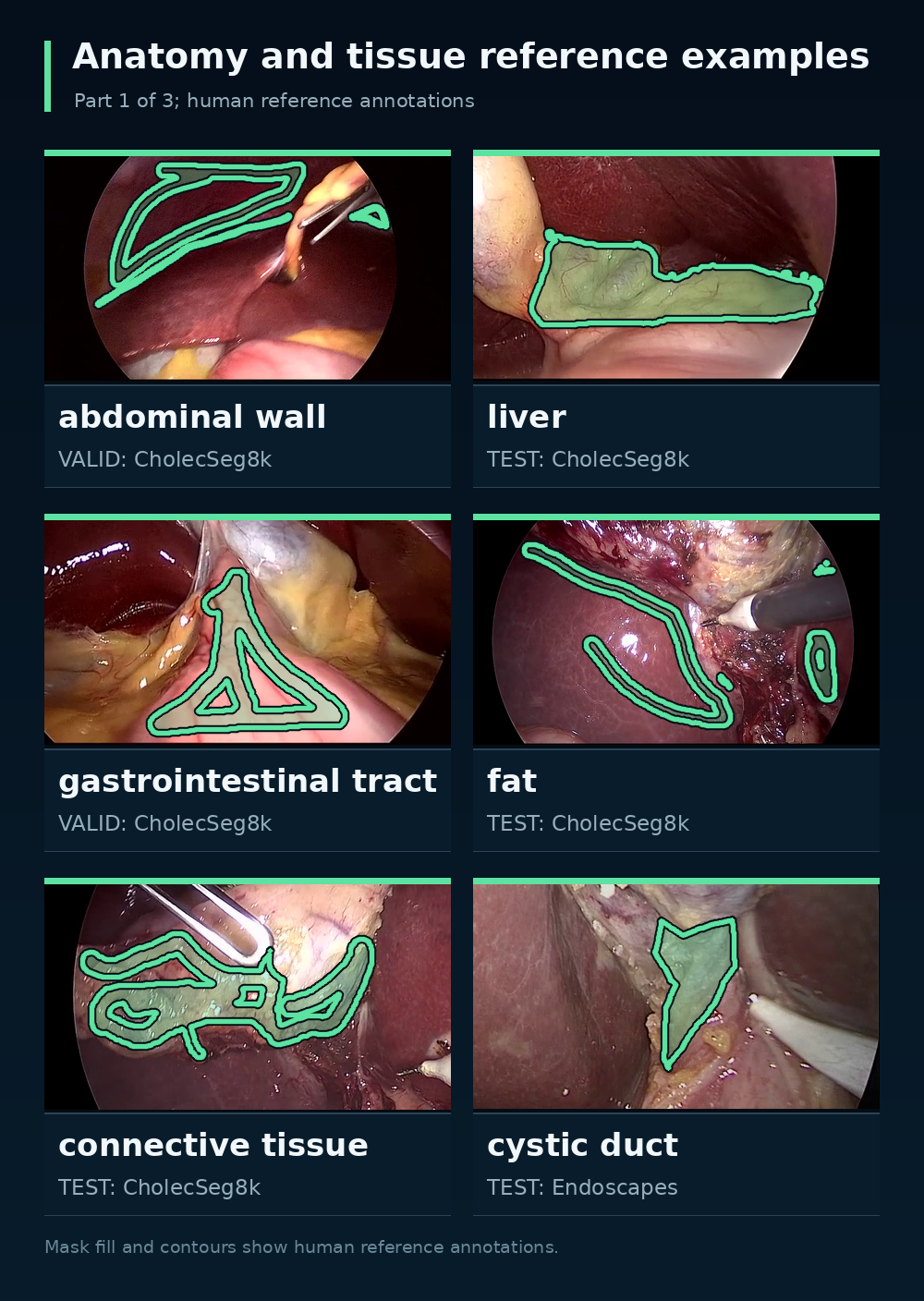 Reference masks for abdominal wall, liver, gastrointestinal tract, fat, connective tissue, and cystic duct