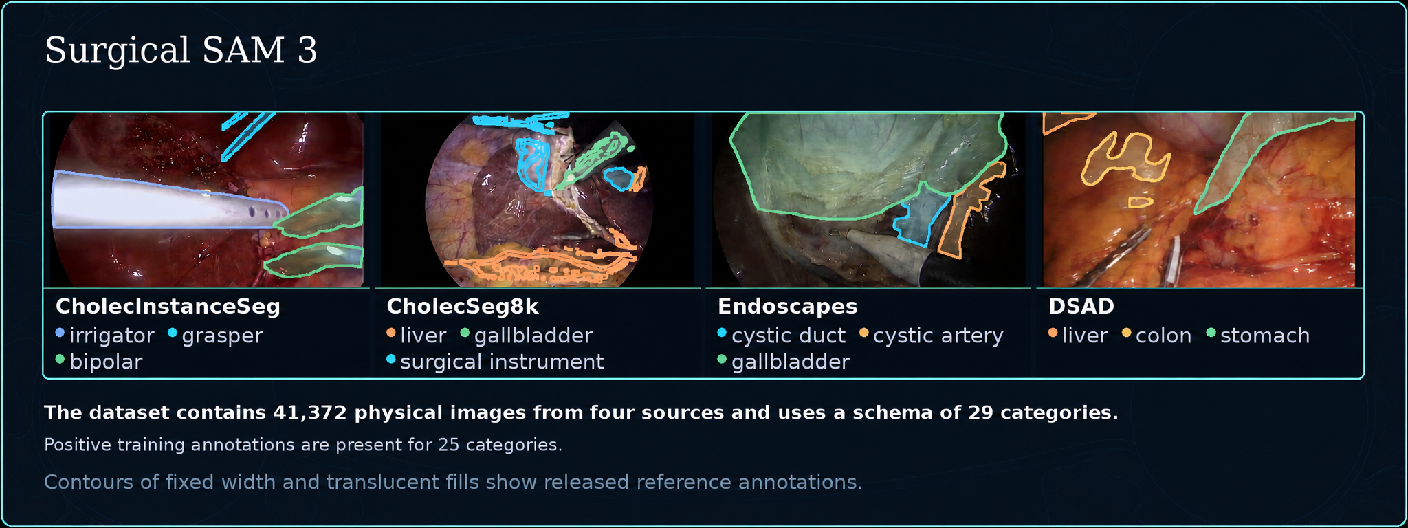 Examples from four surgical datasets with reference masks for instruments and anatomy