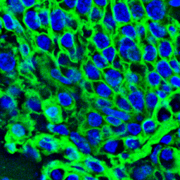 pancreas_codex_156.png